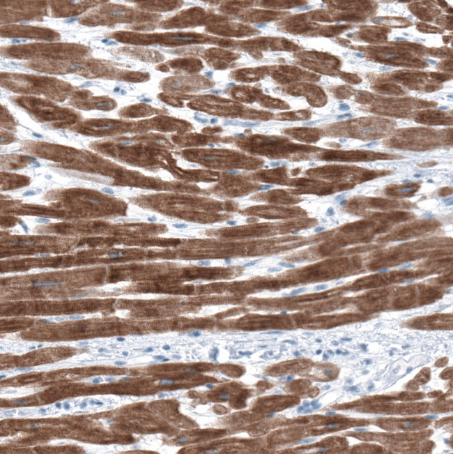 RyR2 Antibody in Immunohistochemistry (Paraffin) (IHC (P))