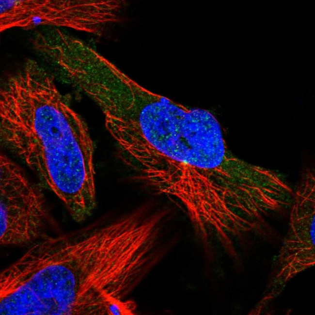 LIS1 Antibody in Immunocytochemistry (ICC/IF)