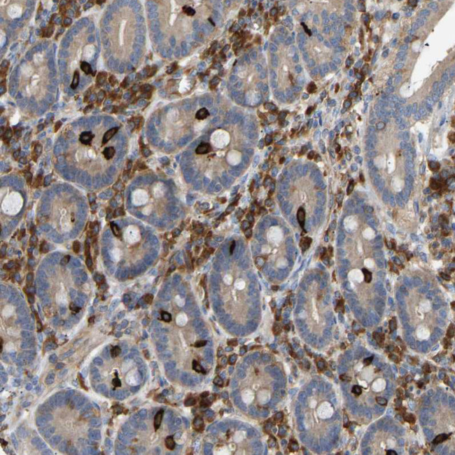 PLCG2 Antibody in Immunohistochemistry (Paraffin) (IHC (P))