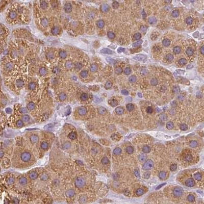 EPHX1 Antibody in Immunohistochemistry (Paraffin) (IHC (P))