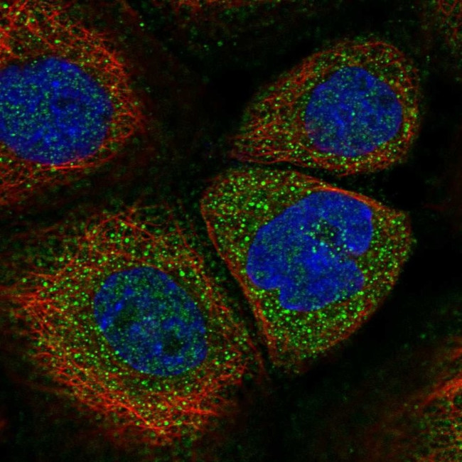 SOCS5 Antibody in Immunocytochemistry (ICC/IF)