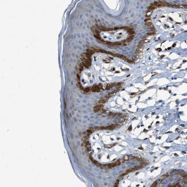 ASS1 Antibody in Immunohistochemistry (Paraffin) (IHC (P))