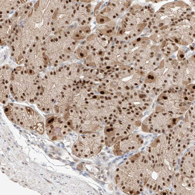 APIP Antibody in Immunohistochemistry (Paraffin) (IHC (P))