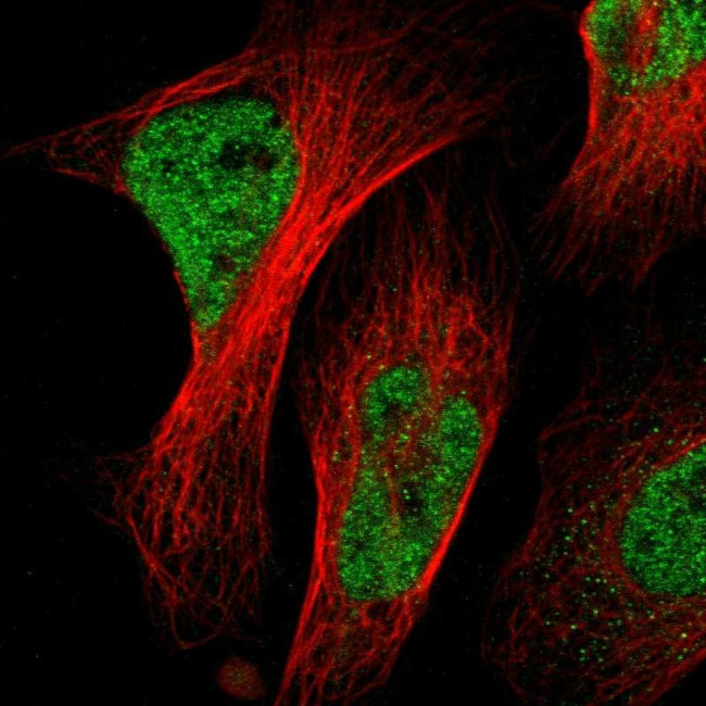 NAC1 Antibody in Immunocytochemistry (ICC/IF)