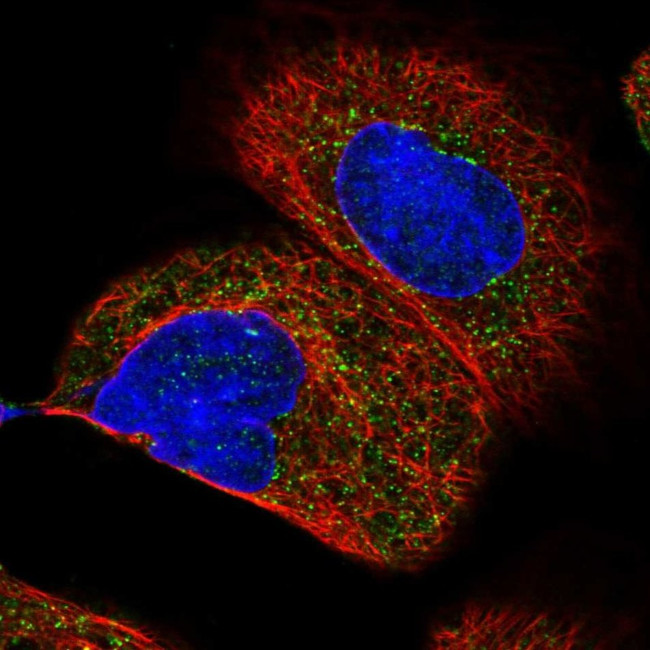 HSD17B4 Antibody in Immunocytochemistry (ICC/IF)