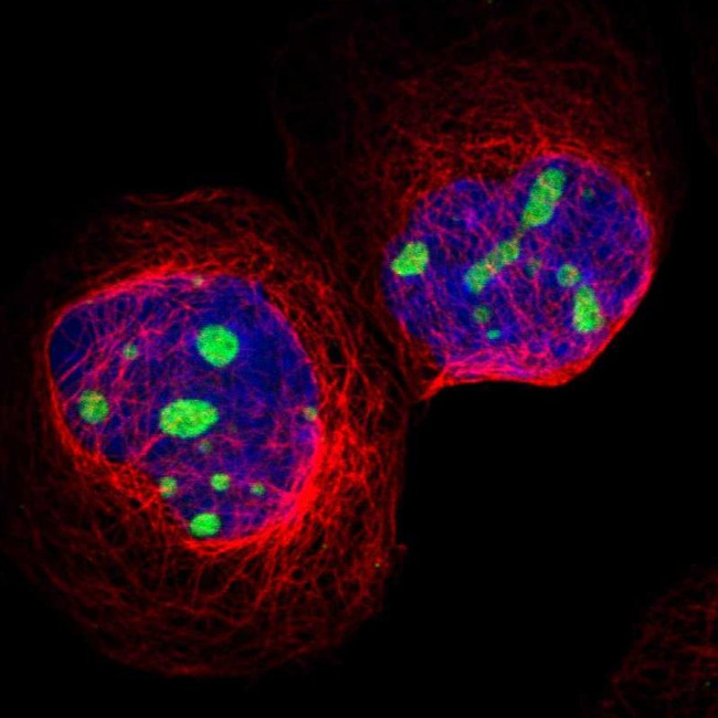 CPS1 Antibody in Immunocytochemistry (ICC/IF)