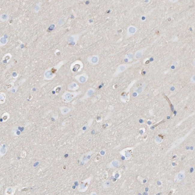 PRKD2 Antibody in Immunohistochemistry (Paraffin) (IHC (P))