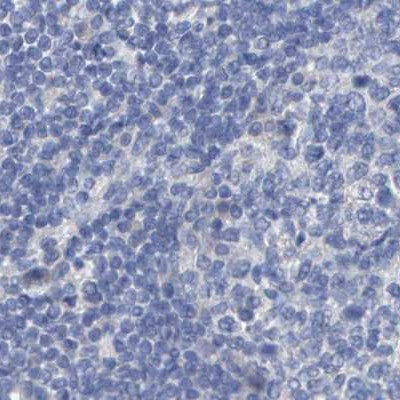 CTH Antibody in Immunohistochemistry (Paraffin) (IHC (P))