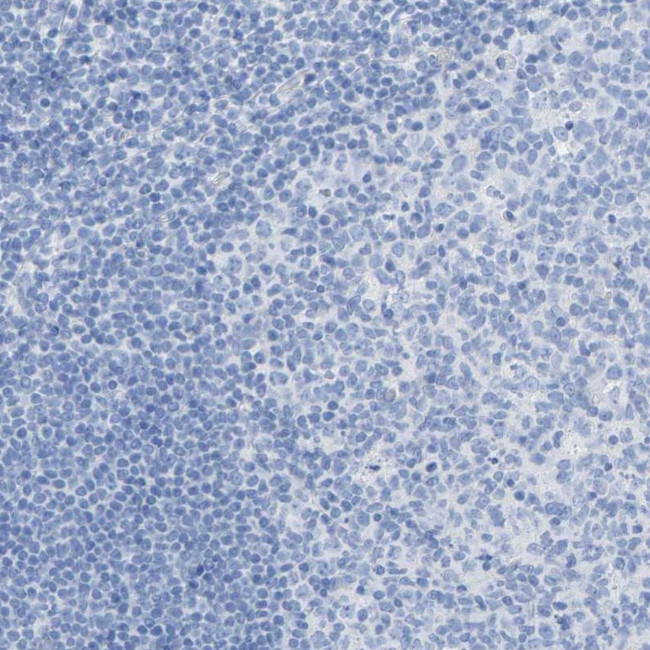 Carboxypeptidase A1 Antibody in Immunohistochemistry (Paraffin) (IHC (P))