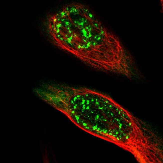 MAGEA4 Antibody in Immunocytochemistry (ICC/IF)