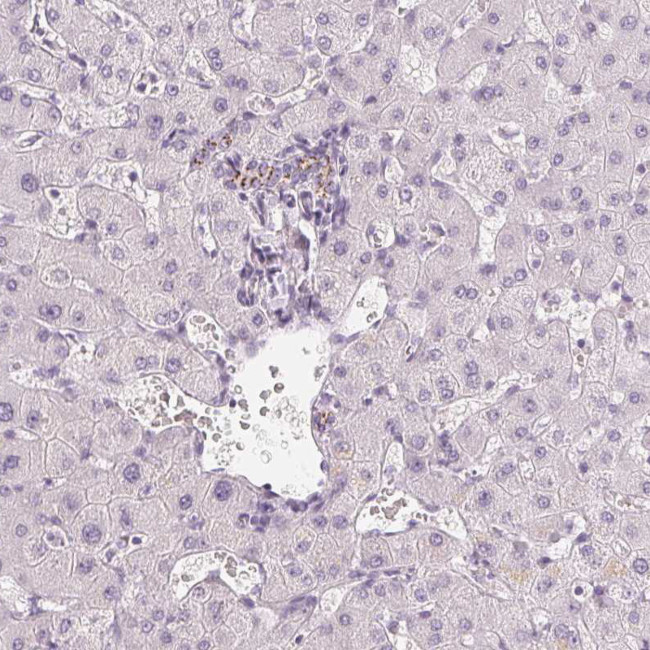 CHST4 Antibody in Immunohistochemistry (Paraffin) (IHC (P))