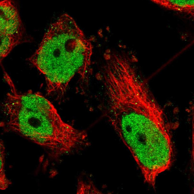 ATF2 Antibody in Immunocytochemistry (ICC/IF)