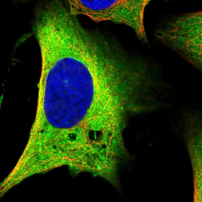 MAP1B Antibody in Immunocytochemistry (ICC/IF)