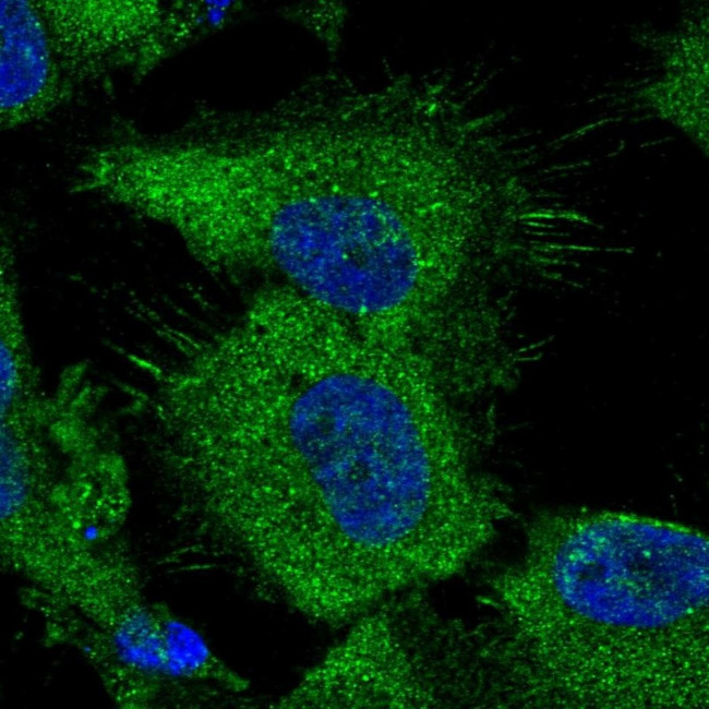 ATP Citrate Lyase Antibody in Immunocytochemistry (ICC/IF)