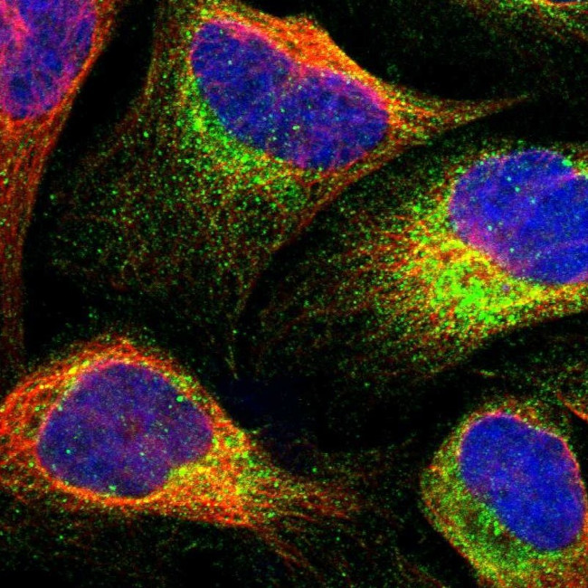 CALCOCO2 Antibody in Immunocytochemistry (ICC/IF)