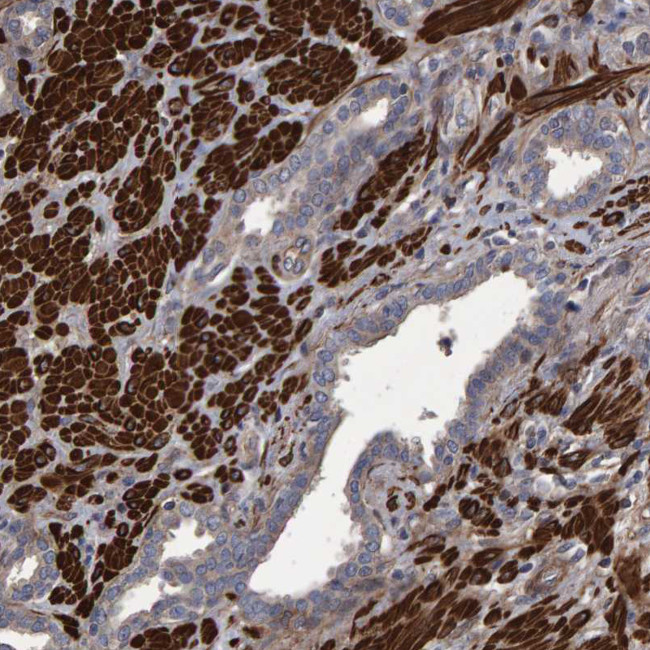 SLIT2 Antibody in Immunohistochemistry (Paraffin) (IHC (P))