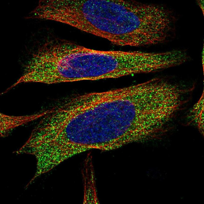 EPHX2 Antibody in Immunocytochemistry (ICC/IF)