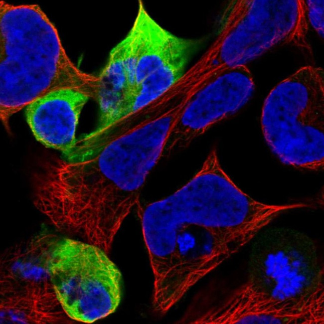 NEFM Antibody in Immunocytochemistry (ICC/IF)