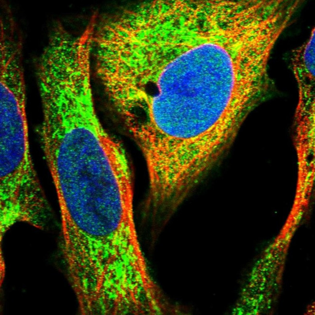 DECR1 Antibody in Immunocytochemistry (ICC/IF)