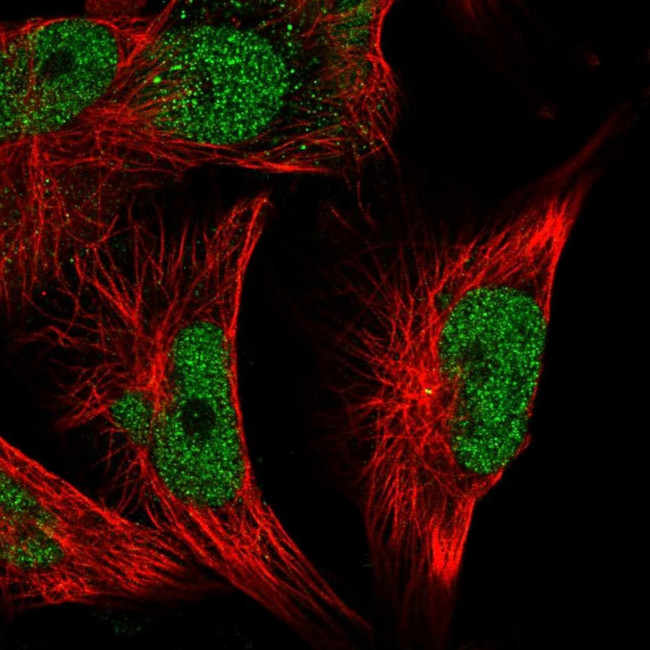 MSK2 Antibody in Immunocytochemistry (ICC/IF)