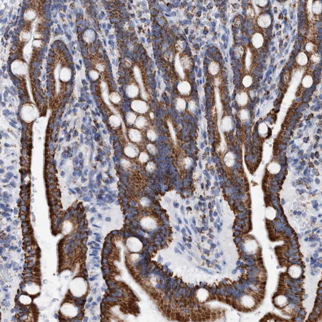 DECR1 Antibody in Immunohistochemistry (Paraffin) (IHC (P))