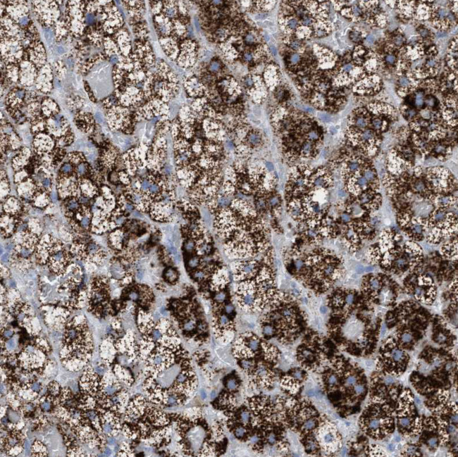 SGSH Antibody in Immunohistochemistry (Paraffin) (IHC (P))