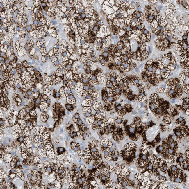 SGSH Antibody in Immunohistochemistry (Paraffin) (IHC (P))