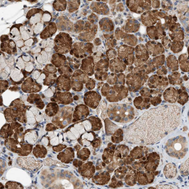 4EBP1 Antibody in Immunohistochemistry (Paraffin) (IHC (P))