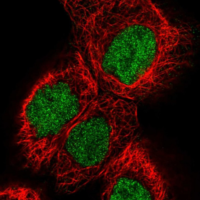 PYGO2 Antibody in Immunocytochemistry (ICC/IF)