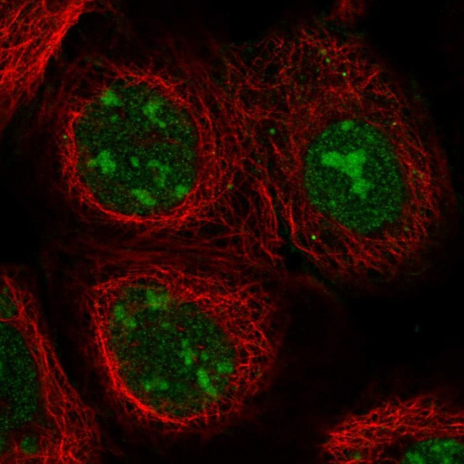 Nucleolin Antibody in Immunocytochemistry (ICC/IF)