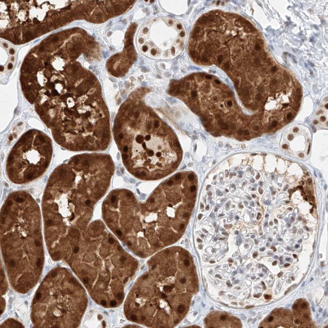 APIP Antibody in Immunohistochemistry (Paraffin) (IHC (P))