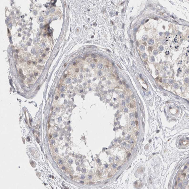 BICD2 Antibody in Immunohistochemistry (Paraffin) (IHC (P))