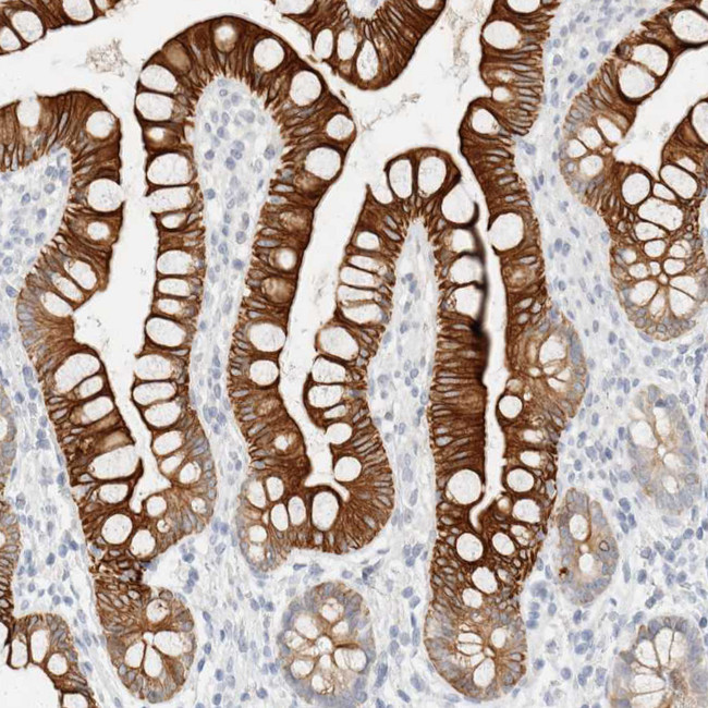 Cytokeratin 20 Antibody in Immunohistochemistry (Paraffin) (IHC (P))