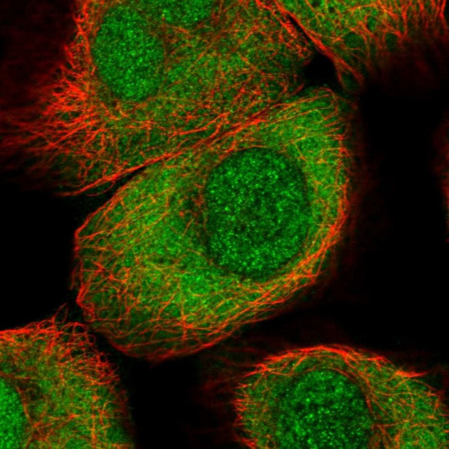 PIMT Antibody in Immunocytochemistry (ICC/IF)