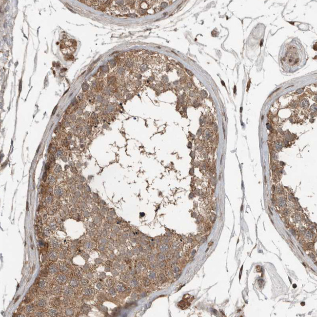 BLZF1 Antibody in Immunohistochemistry (Paraffin) (IHC (P))