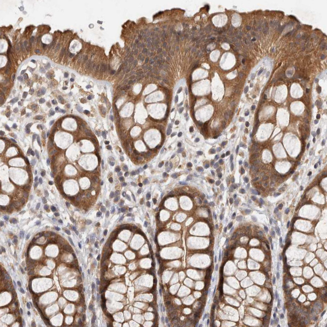 ACAT2 Antibody in Immunohistochemistry (Paraffin) (IHC (P))