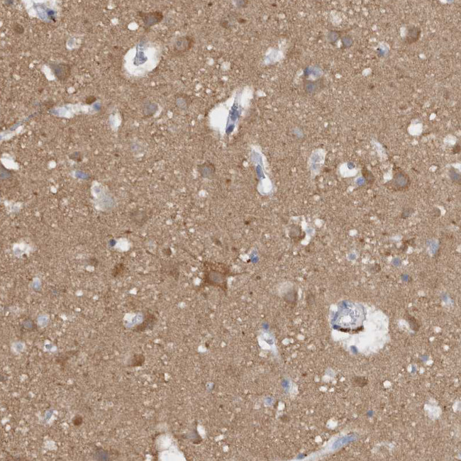 CaMKII delta Antibody in Immunohistochemistry (Paraffin) (IHC (P))