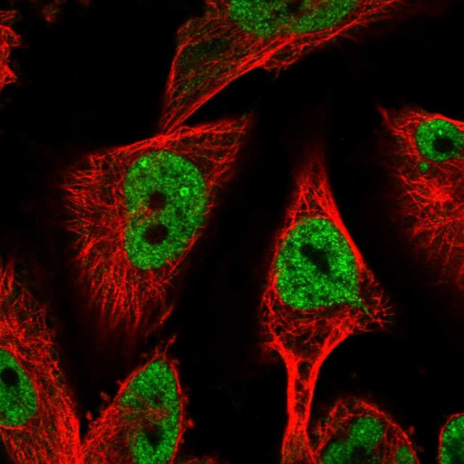 HDAC6 Antibody in Immunocytochemistry (ICC/IF)