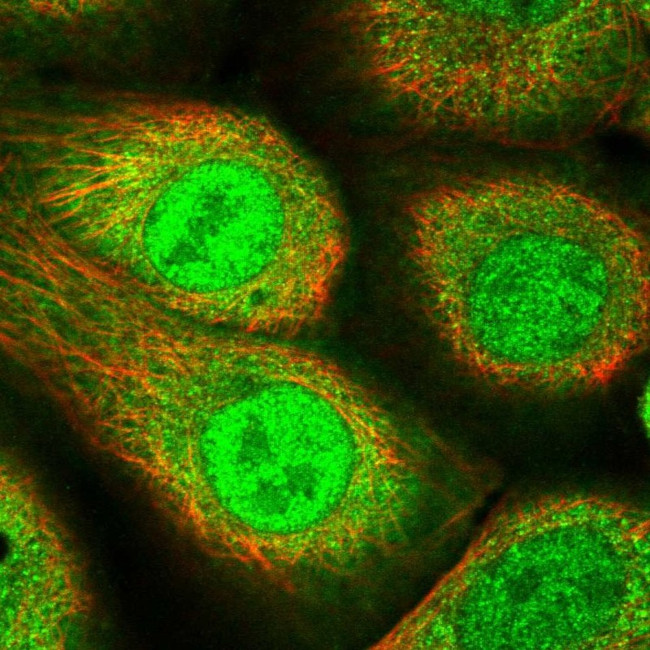 AKR1B1 Antibody in Immunocytochemistry (ICC/IF)