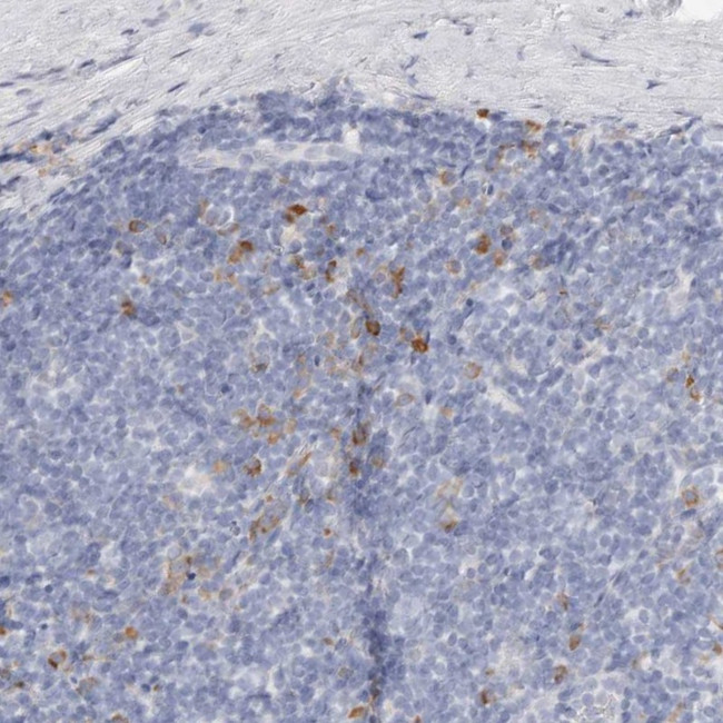 CSK Antibody in Immunohistochemistry (Paraffin) (IHC (P))