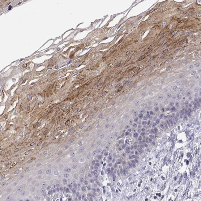 ERO1L Antibody in Immunohistochemistry (Paraffin) (IHC (P))