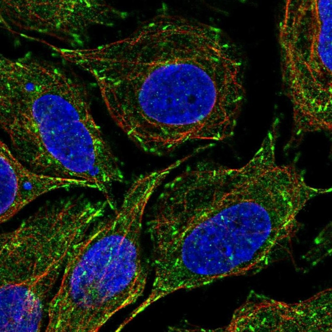 CLIP1 Antibody in Immunocytochemistry (ICC/IF)