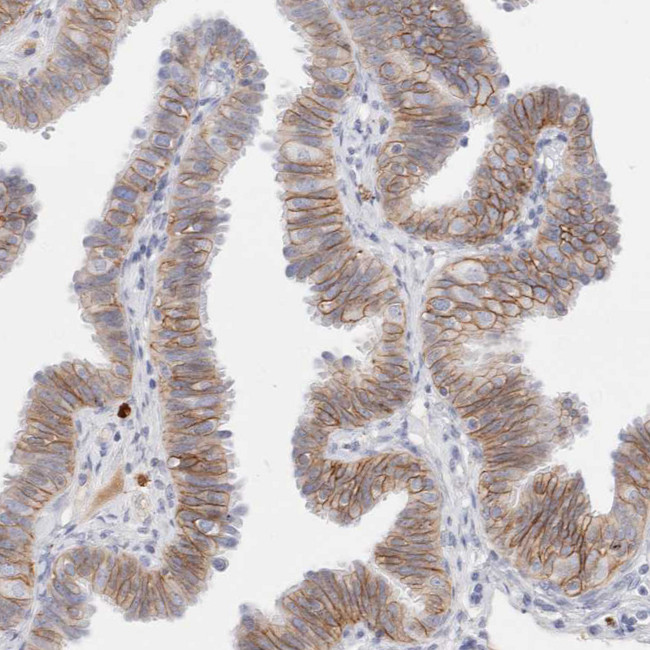 EpCAM Antibody in Immunohistochemistry (Paraffin) (IHC (P))