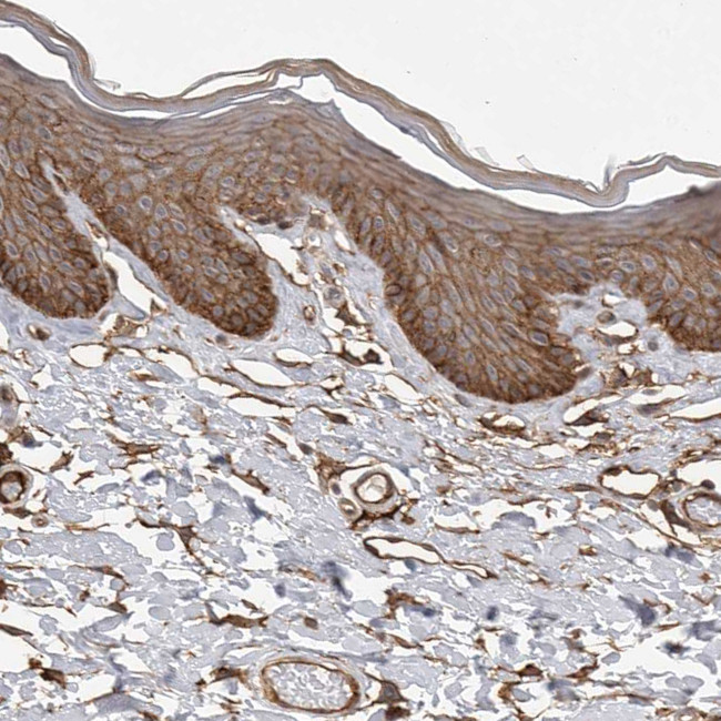 Nectin 1 Antibody in Immunohistochemistry (Paraffin) (IHC (P))