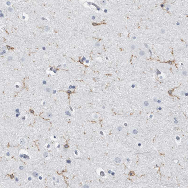 FCER1G Antibody in Immunohistochemistry (Paraffin) (IHC (P))