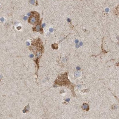 GANAB Antibody in Immunohistochemistry (Paraffin) (IHC (P))