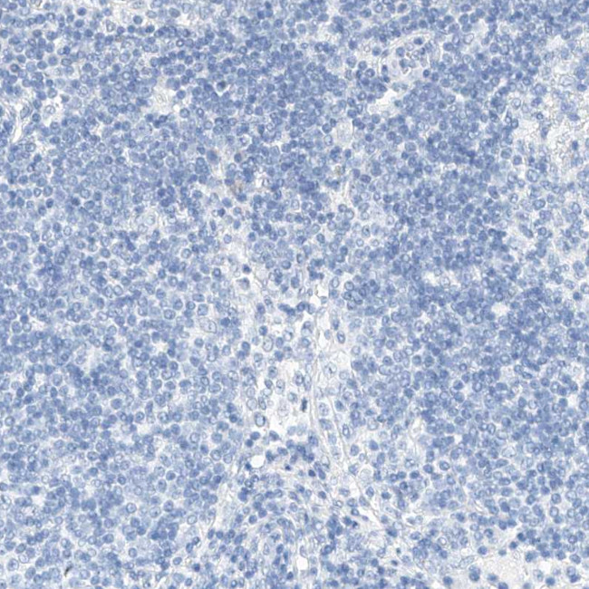 Kir1.1 (KCNJ1) Antibody in Immunohistochemistry (Paraffin) (IHC (P))