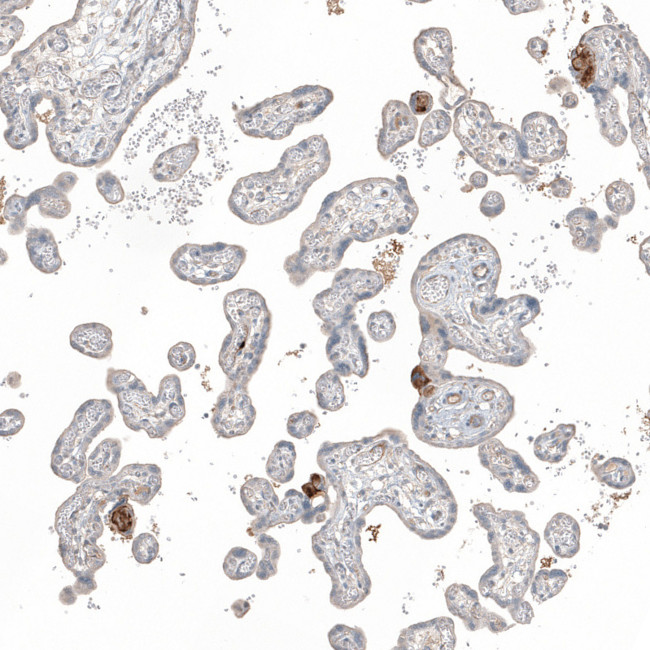 Fibronectin Antibody in Immunohistochemistry (Paraffin) (IHC (P))