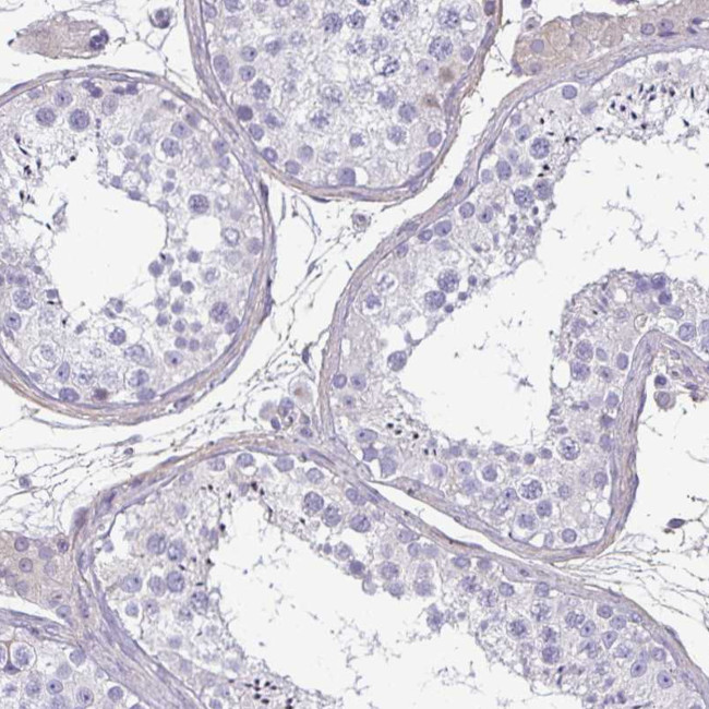 ECM1 Antibody in Immunohistochemistry (Paraffin) (IHC (P))