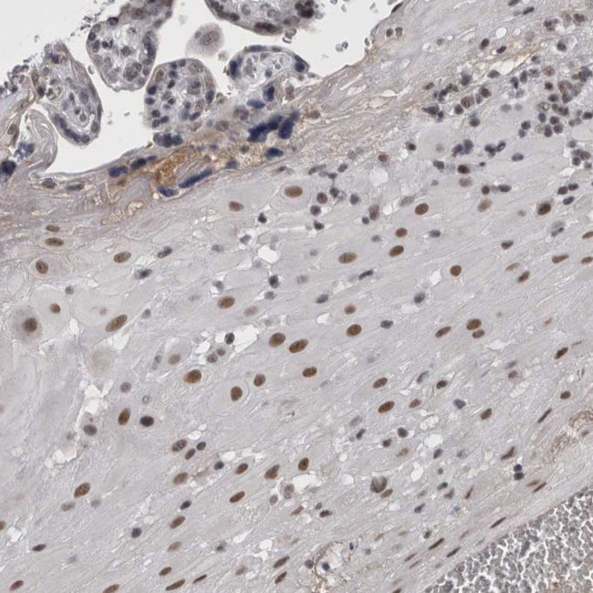 BRCAA1 Antibody in Immunohistochemistry (Paraffin) (IHC (P))